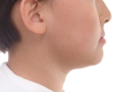9세 주걱턱·앞니 반대교합 성장기 교정｜페이스마스크로 골격성 3급 개선한 실제 증례
