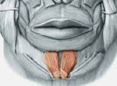 미금역교정치과 자갈턱(호두주름) 교정치료로 개선한 실제 사례 | 서울리인치과교정과
