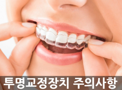 인비절라인 올바른 착용 방법과 주의사항 I 분당교정치과