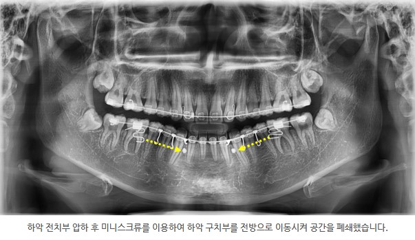 a4209e435b72b1920886d3c55ae8bd4a 1788931446 3781
