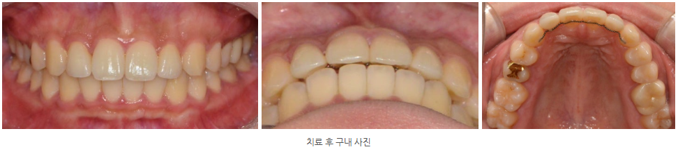 056c7b8f5f907d9791deabfa8b76501e_1763630030_9623.png 056c7b8f5f907d9791deabfa8b76501e_1763630030_9623.png