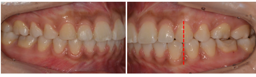 6bd6c6c178124bb1ac90c140aac59390_1764040498_6474.png 6bd6c6c178124bb1ac90c140aac59390_1764040498_6474.png