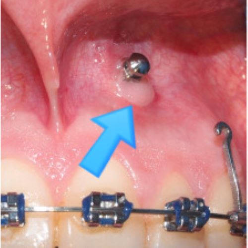 6e2c4d88267773aa44acd9ea1cae1141_1763966618_6547.jpg 6e2c4d88267773aa44acd9ea1cae1141_1763966618_6547.jpg