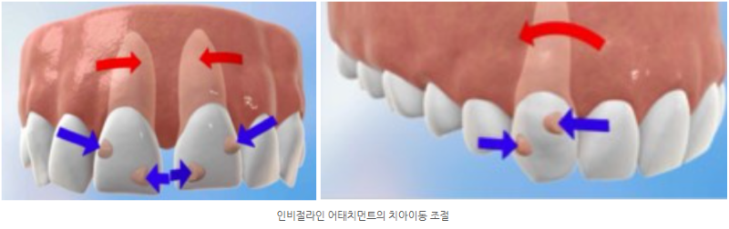 6e2c4d88267773aa44acd9ea1cae1141_1763969882_3388.png 6e2c4d88267773aa44acd9ea1cae1141_1763969882_3388.png