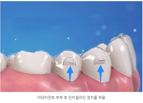 6e2c4d88267773aa44acd9ea1cae1141_1763969940_5957.png 6e2c4d88267773aa44acd9ea1cae1141_1763969940_5957.png