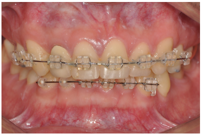 6e2c4d88267773aa44acd9ea1cae1141_1763972172_2652.png 6e2c4d88267773aa44acd9ea1cae1141_1763972172_2652.png