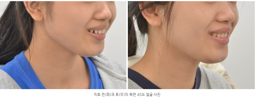 7ae2bcc2e7645b78977f00d5dd219229_1764378157_4635.png 7ae2bcc2e7645b78977f00d5dd219229_1764378157_4635.png