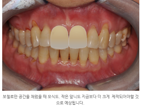 7ae2bcc2e7645b78977f00d5dd219229_1764379227_7217.png 7ae2bcc2e7645b78977f00d5dd219229_1764379227_7217.png