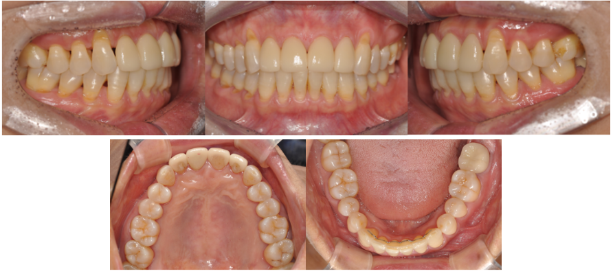 7ae2bcc2e7645b78977f00d5dd219229_1764379268_9372.png 7ae2bcc2e7645b78977f00d5dd219229_1764379268_9372.png