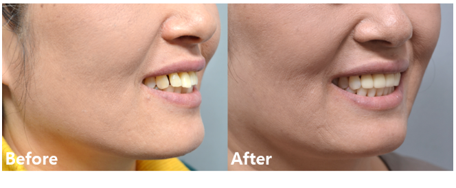 7ae2bcc2e7645b78977f00d5dd219229_1764379331_8799.png 7ae2bcc2e7645b78977f00d5dd219229_1764379331_8799.png