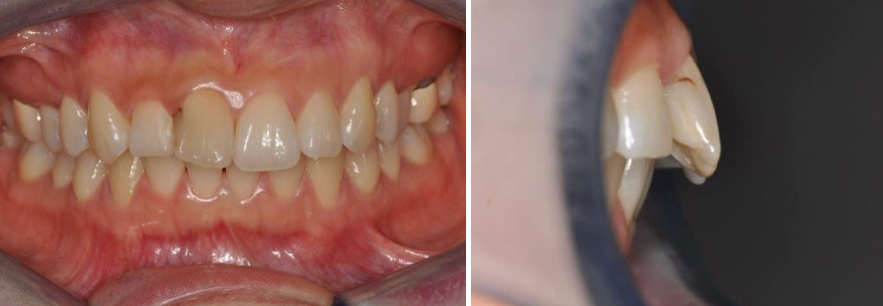 8cec2fb17d22f2abcf7cc8507c366fae_1763371540_6441.png 8cec2fb17d22f2abcf7cc8507c366fae_1763371540_6441.png