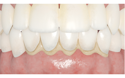 a79642d4c465296dc3eab8eae7d012ea 1763368098 6877