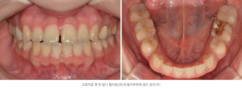 d288e28aef4e460cf554a62a4b3e0fb5_1763814189_7719.png d288e28aef4e460cf554a62a4b3e0fb5_1763814189_7719.png