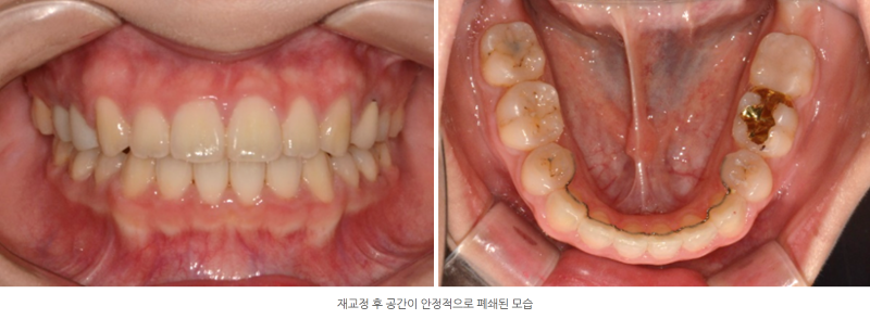 d288e28aef4e460cf554a62a4b3e0fb5_1763814189_8252.png d288e28aef4e460cf554a62a4b3e0fb5_1763814189_8252.png