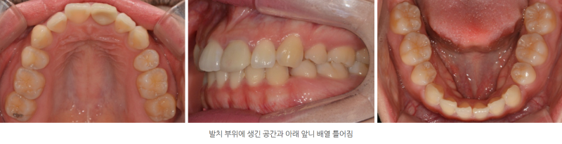 d288e28aef4e460cf554a62a4b3e0fb5_1763814189_8835.png d288e28aef4e460cf554a62a4b3e0fb5_1763814189_8835.png