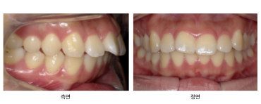 d2a0301735656edfd5c4fff5e3c4234e_1763219842_0402.png d2a0301735656edfd5c4fff5e3c4234e_1763219842_0402.png