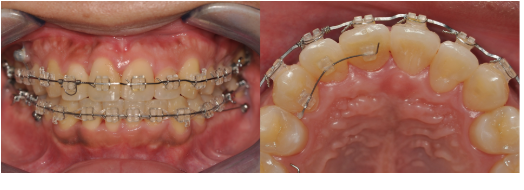 54f75e61760e93d0078492f7f3506599_1764551908_2665.png 54f75e61760e93d0078492f7f3506599_1764551908_2665.png