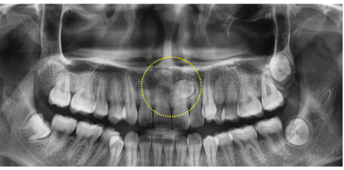 54f75e61760e93d0078492f7f3506599_1764551988_2155.png 54f75e61760e93d0078492f7f3506599_1764551988_2155.png