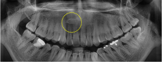 54f75e61760e93d0078492f7f3506599_1764552039_159.png 54f75e61760e93d0078492f7f3506599_1764552039_159.png