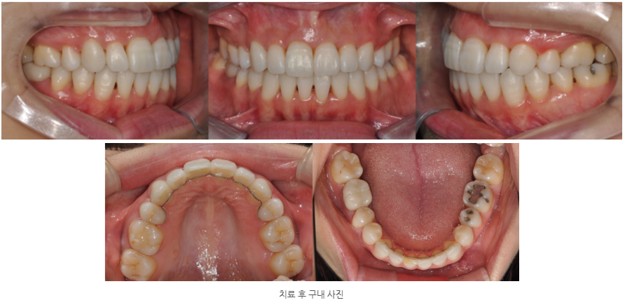 54f75e61760e93d0078492f7f3506599_1764552059_8616.png 54f75e61760e93d0078492f7f3506599_1764552059_8616.png