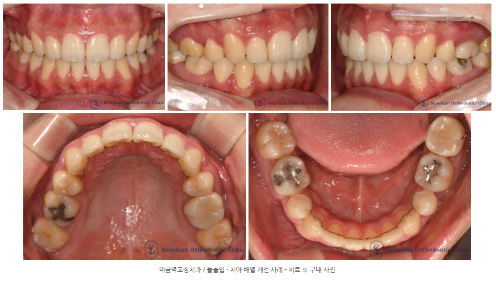 6d26a7eb2072bacd18803b488452df60 1766046415 2419 6d26a7eb2072bacd18803b488452df60 1766046415 2419