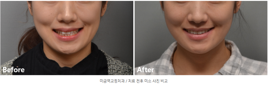 b736ae63aa1250bfa1963d20c7c52e4a 1766197542 2184 b736ae63aa1250bfa1963d20c7c52e4a 1766197542 2184