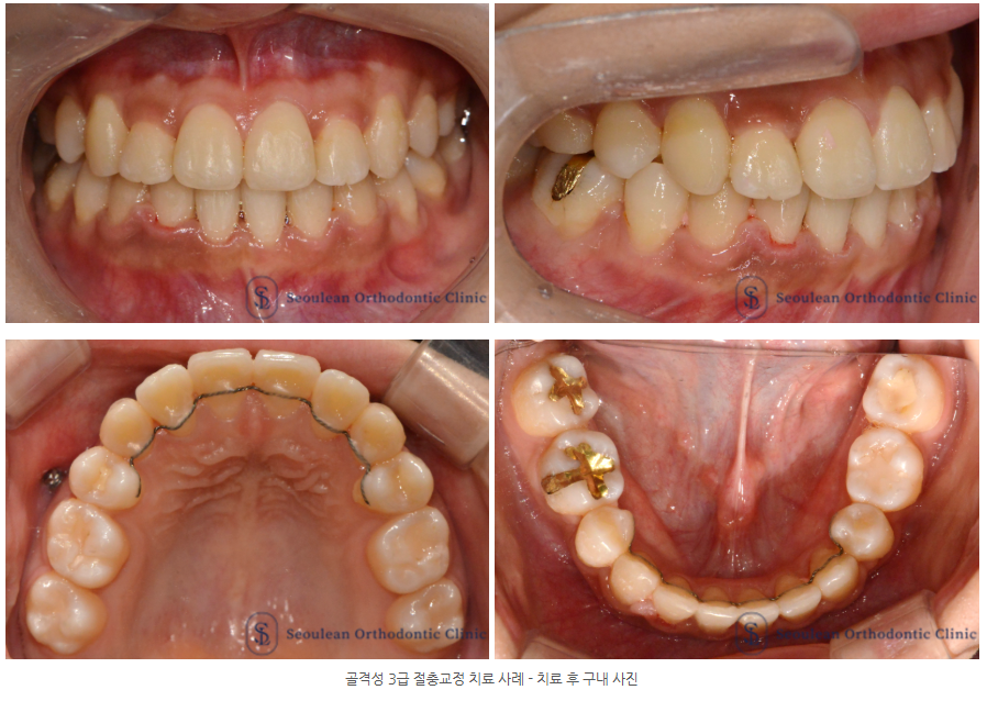 6d7ddec28336d25e8a8e62f52b00fa36 1769478718 0886 6d7ddec28336d25e8a8e62f52b00fa36 1769478718 0886