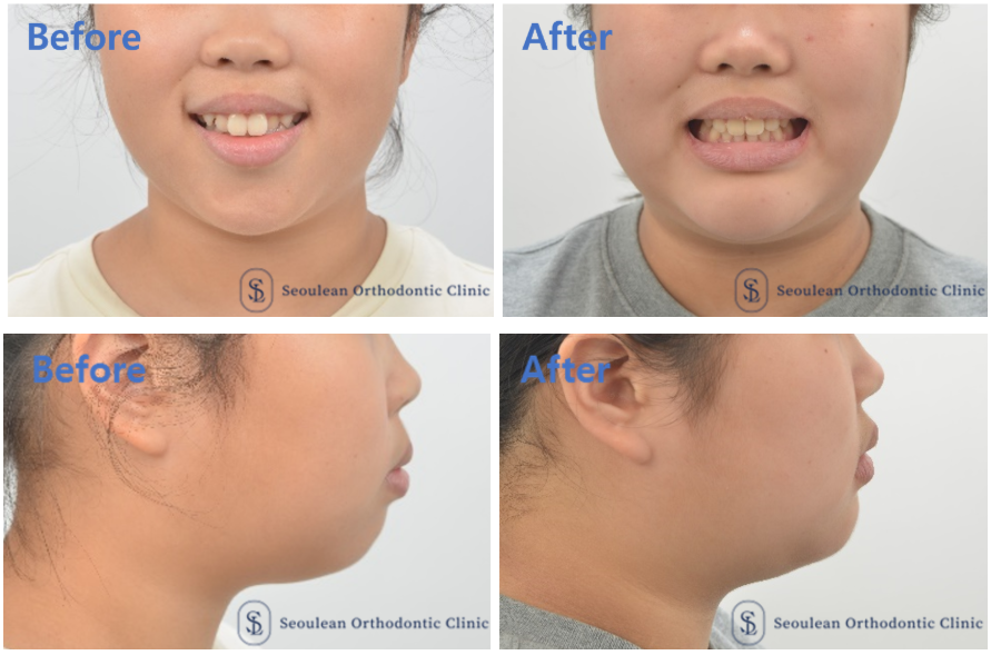 d28874177add3a06b5742b46cbfef6cf 1770082798 3283