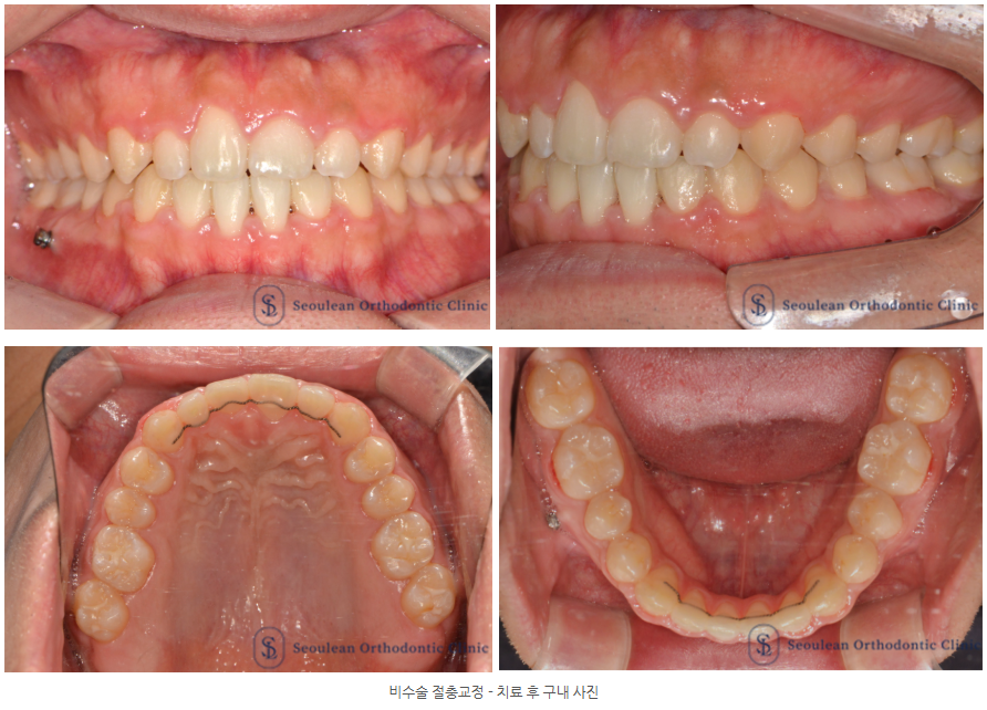 efab356bda655df37514c22fc23b113c 1770690237 3525 efab356bda655df37514c22fc23b113c 1770690237 3525